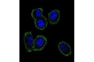 Confocal immunofluorescent analysis of NMB Antibody (Center) (ABIN651541 and ABIN2840290) with MDA-M cell followed by Alexa Fluor 488-conjugated goat anti-rabbit lgG (green). (Neuromedin B antibody  (AA 15-42))