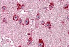 Human Brain, Cortex (formalin-fixed, paraffin-embedded) stained with NR3C2 antibody ABIN396956 at 1:50 followed by biotinylated anti-mouse IgG secondary antibody ABIN481714, alkaline phosphatase-streptavidin and chromogen. (NR3C2 antibody)