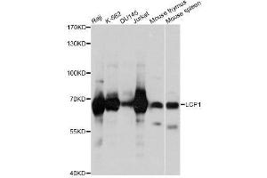 Western blot analysis of extracts of various cell lines, using LCP1 antibody. (LCP1 antibody  (AA 1-270))