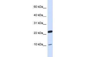 WB Suggested Anti-TAF13 Antibody Titration:  0.