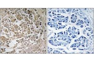 Immunohistochemistry (IHC) image for anti-Peroxisome Biogenesis Factor 11 gamma (PEX11G) (AA 11-60) antibody (ABIN2890491) (PEX11G antibody  (AA 11-60))