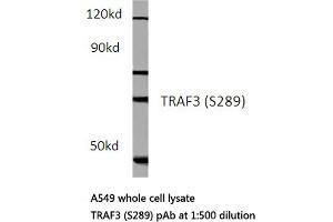 Western blot (WB) analysis of TCF-3 antibody in extracts from hela cells.