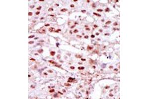 Image no. 2 for anti-Casein Kinase 2 alpha 1 (CSNK2A1) (Middle Region) antibody (ABIN360651) (CSNK2A1/CK II alpha antibody  (Middle Region))