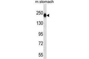 Western Blotting (WB) image for anti-Tenascin N (TNN) antibody (ABIN2997436)