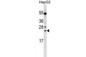 Western Blotting (WB) image for anti-Leucine Rich Repeat Containing 29 (LRRC29) antibody (ABIN2999686)