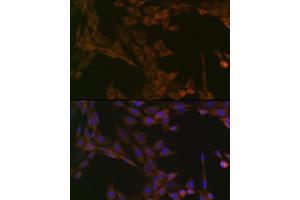 Immunofluorescence analysis of NIH-3T3 cells using SMYD3 Rabbit mAb (ABIN3015902, ABIN3015903, ABIN1680302 and ABIN1680303) at dilution of 1:100 (40x lens). (SMYD3 antibody)