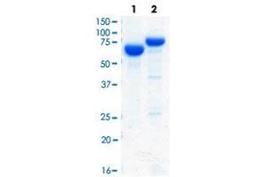 Loading 2 ug protein in SDS-PAGE: Lane1: BSA, Lane2: His-GARS. (GARS Protein (His tag))