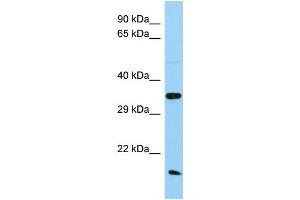 Host: Rabbit Target Name: Ak1 Sample Type: Rat Testis lysates Antibody Dilution: 1. (Adenylate Kinase 1 antibody  (Middle Region))