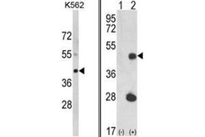 (LEFT) Western blot analysis of LUC7L Antibody (C-term) in K562 cell line lysates (35ug/lane). (LUC7L antibody  (C-Term))