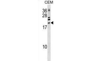 Western Blotting (WB) image for anti-Activating Transcription Factor 3 (ATF3) antibody (ABIN2998842) (ATF3 antibody)