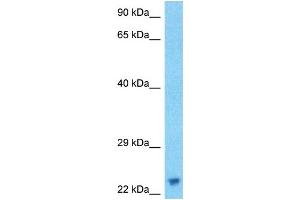 Host:  Rabbit  Target Name:  ASCL1  Sample Type:  RPMI-8226 Whole Cell lysates  Antibody Dilution:  1. (ASCL1 antibody  (N-Term))