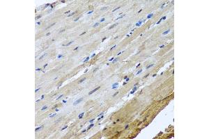 Immunohistochemistry of paraffin-embedded rat heart using NUMA1 antibody. (NUMA1 antibody)