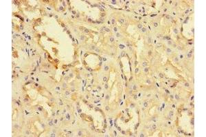Immunohistochemistry of paraffin-embedded human kidney tissue using ABIN7173726 at dilution of 1:100 (TPPP3 antibody  (AA 2-176))