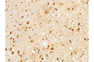 ABIN6267283 at 1/100 staining human brain tissue sections by IHC-P. (ErbB2/Her2 antibody  (pTyr1248))