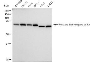 anti-Cytochrome B-561 (CYB561) antibody