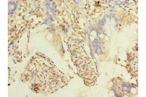 Immunohistochemistry of paraffin-embedded human small intestine tissue using ABIN7173386 at dilution of 1:100 (TMEM38B antibody  (AA 249-291))