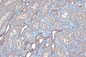Immunohistochemistry of paraffin-embedded mouse kidney using Raptor Rabbit mAb (ABIN7269900) at dilution of 1:100 (40x lens). (Raptor antibody)