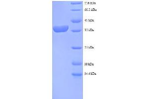 SDS-PAGE (SDS) image for Ribosomal Protein S12 (RPS12) (AA 1-132), (full length) protein (GST tag) (ABIN7479211)