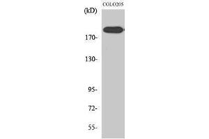 Western Blotting (WB) image for anti-DNA Repair Protein Complementing XP-G Cells (ERCC5) (N-Term) antibody (ABIN3187504) (ERCC5 antibody  (N-Term))