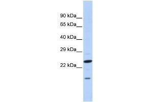 WB Suggested Anti-INSIG2 Antibody Titration:  0. (INSIG2 antibody  (N-Term))
