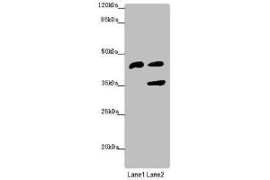 Western blot All lanes: SERPINB6 antibody at 0. (SERPINB6 antibody  (AA 180-300))