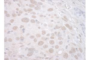 Immunohistochemistry (IHC) image for anti-Catenin, beta Like 1 (CTNNBL1) (AA 1-50) antibody (ABIN7448501)
