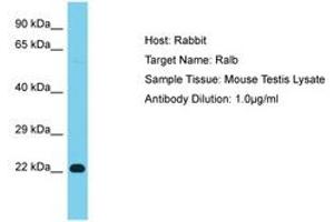 Image no. 1 for anti-V-Ral Simian Leukemia Viral Oncogene Homolog B (Ras Related, GTP Binding Protein) (Ralb) (AA 97-146) antibody (ABIN6750361) (RALB antibody  (AA 97-146))