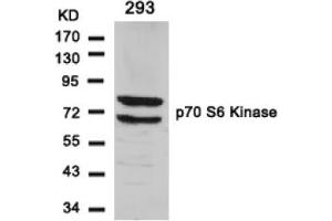 Image no. 3 for anti-Ribosomal Protein S6 Kinase, 70kDa, Polypeptide 1 (RPS6KB1) (Ser411) antibody (ABIN197526)
