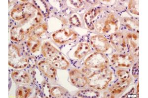 Formalin-fixed and paraffin embedded human kidney labeled with Anti-SGK3 Polyclonal Antibody, Unconjugated (ABIN1387590) at 1:200 followed by conjugation to the secondary antibody and DAB staining