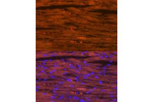 Immunofluorescence analysis of rat heart using Myosin heavy chain Rabbit mAb (ABIN7268750) at dilution of 1:100 (40x lens). (MYH7 antibody)