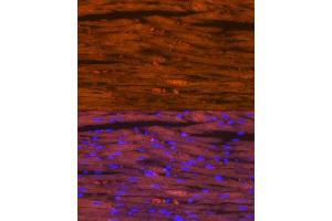 Immunofluorescence analysis of rat heart using Myosin heavy chain Rabbit mAb (ABIN7268750) at dilution of 1:100 (40x lens). (MYH7 antibody)