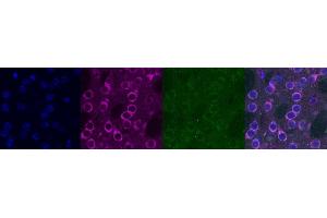 Immunohistochemistry (IHC) image for anti-Kv Channel Interacting Protein 2 (KCNIP2) antibody (ABIN7456313) (KCNIP2 antibody)