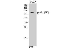 Western Blotting (WB) image for anti-Proto-oncogene tyrosine-protein kinase Src (Src) (pSer75) antibody (ABIN3182677) (Src antibody  (pSer75))