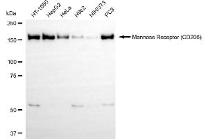 Western blotting analysis using mannose receptor (CD206) antibody (ABIN7799329). (Recombinant Mannose Receptor antibody)