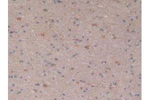 IHC-P analysis of Human Brain Tissue, with DAB staining. (NFkB antibody  (AA 805-892))