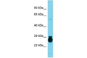 Host:  Rabbit  Target Name:  Hoxc6  Sample Type:  Rat Small Intestine lysates  Antibody Dilution:  1. (Homeobox C6 antibody  (Middle Region))