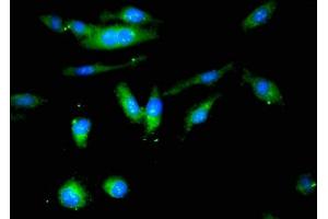 Immunofluorescent analysis of Hela cells using ABIN7147632 at dilution of 1:100 and Alexa Fluor 488-congugated AffiniPure Goat Anti-Rabbit IgG(H+L) (Butyrylcholinesterase antibody  (AA 311-524))