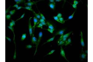 Immunofluorescence staining of Hela cells with ABIN7143093 at 1:100, counter-stained with DAPI. (ARPC4 antibody  (AA 2-168))