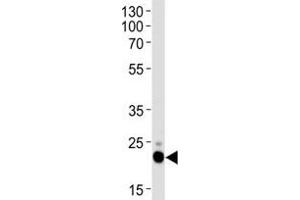 Western blot analysis of lysate from HeLa cell line using CD9 antibody. (CD9 antibody  (AA 115-145))