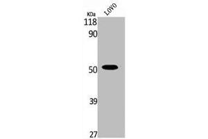 Western Blot analysis of LOVO cells using Phospho-MOR-1 (S375) Polyclonal Antibody (Mu Opioid Receptor 1 antibody  (pSer375))