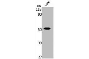 Western Blot analysis of LOVO cells using Phospho-MOR-1 (S375) Polyclonal Antibody