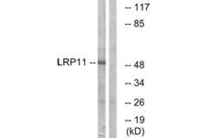 Western blot analysis of extracts from Jurkat cells, using LRP11 Antibody. (LRP11 antibody  (AA 48-97))