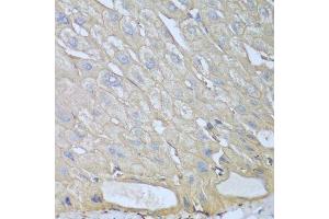 Immunohistochemistry of paraffin-embedded human liver using RPH3AL antibody. (RPH3AL antibody  (AA 161-315))