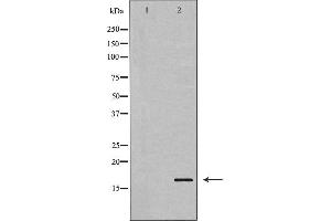 Western blot analysis of Stathmin 1 expression in Jurkat cells. (Stathmin 1 antibody  (N-Term))