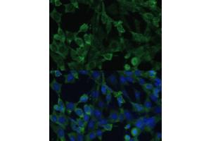 Immunofluorescence (IF) image for anti-Eukaryotic Translation Initiation Factor 1A, X-Linked (EIF1AX) (AA 10-144) antibody (ABIN6140017)
