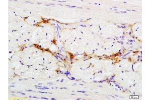 Formalin-fixed and paraffin embedded rat tongue tissue labeled with Anti-CD47/MER6 Polyclonal Antibody, Unconjugated  at 1:200 followed by conjugation to the secondary antibody (CD47 antibody  (AA 241-323))