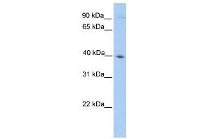 ODF2 antibody used at 1 ug/ml to detect target protein. (ODF2 antibody  (N-Term))
