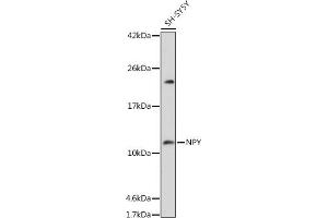 Western Blotting (WB) image for anti-Neuropeptide Y (NPY) (AA 1-97) antibody (ABIN3017529)