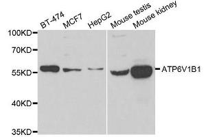 Western blot analysis of extracts of various cell lines, using ATP6V1B1 antibody.