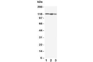 Western blot testing of EIF3B antbody; Lane 1: HeLa;  2: 293T;  3: A431 cell lysate.